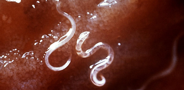 Hookworm